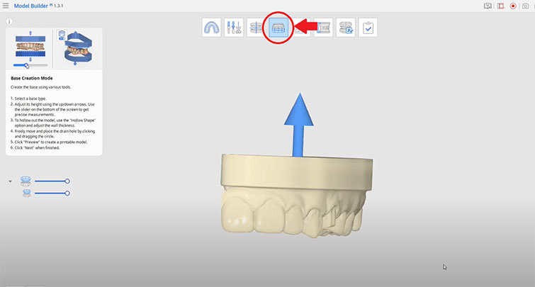 Пошаговое-руководство-по-3D-печати-моделей-коронок-и-мостов-с-помощью-съемных-матриц-5.jpg