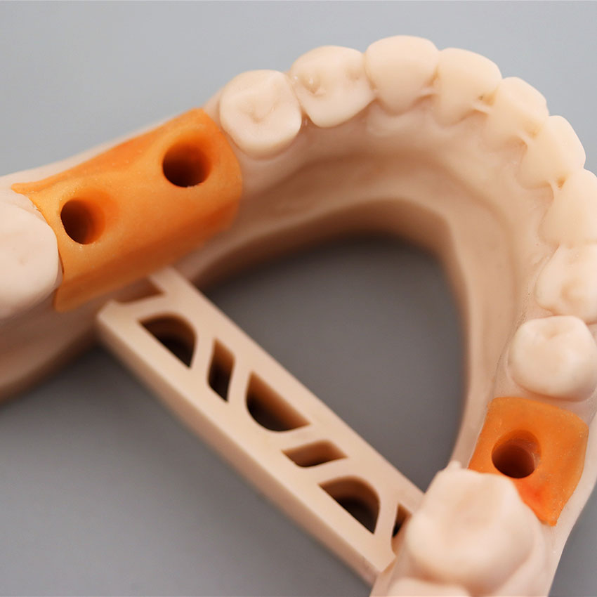 Фотополимерная смола Gorky Liquid Dental Gingiva, розовая (1 кг)