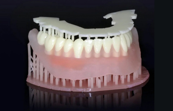 3D печать в стоматологии: новый виток технологической революции