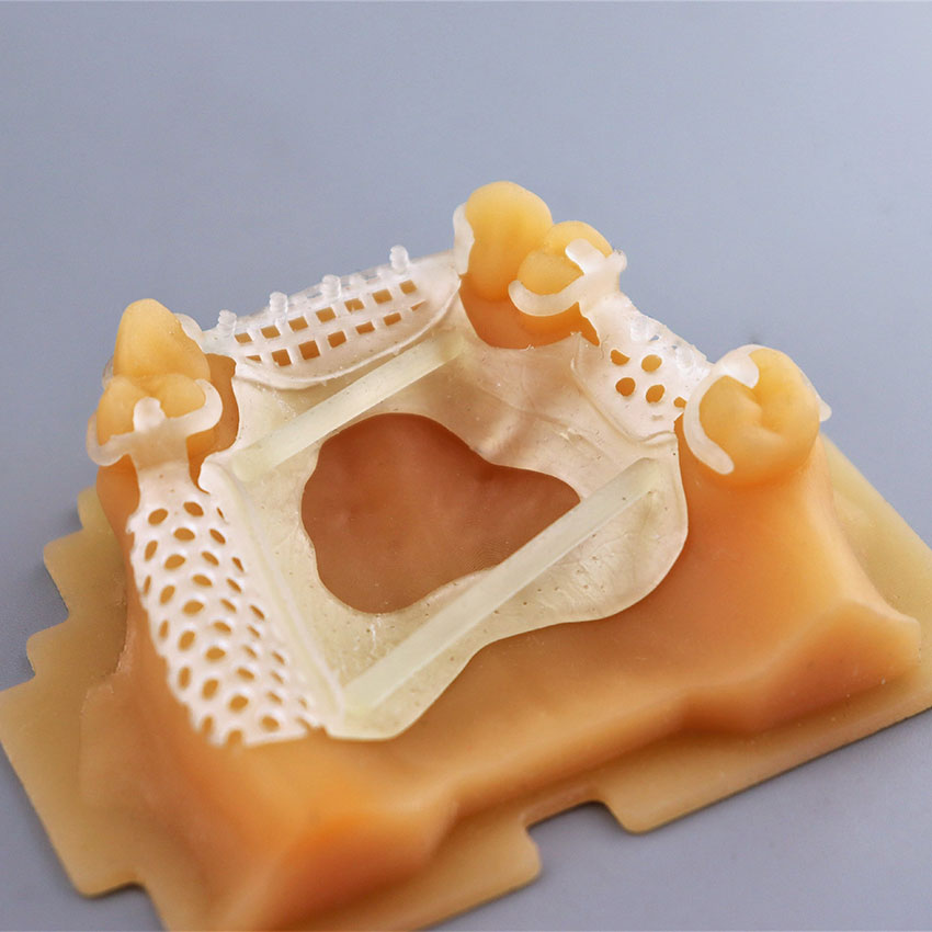 Фотополимерная смола Gorky Liquid Dental Castable, желтая (1 кг)